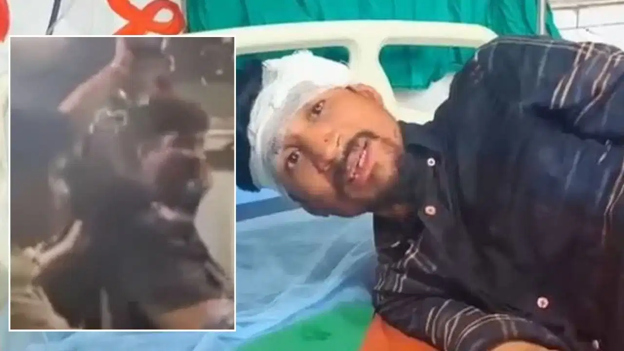 मुंबई लोकल में फिर खूनी संघर्ष! यात्री पर कड़े से हमला, सिर फूटा; पीड़ित बोला- 'चलती ट्रेन से फेंकने की कोशिश की'