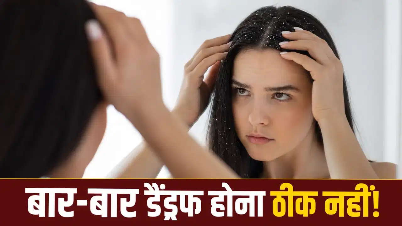 डैंड्रफ सिर्फ गंदगी नहीं, इन वजहों से भी हो सकती है सिर में रूसी