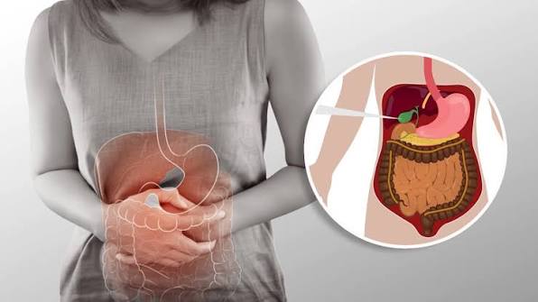 Gallbladder Stones: पित्त की थैली में कैसे बनती है पथरी? जानें लक्षण और इलाज